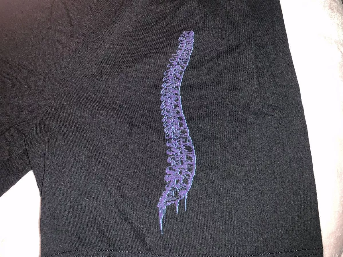 Scalp champion shorts Black